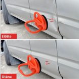 Horpadásjavító tapadókorong