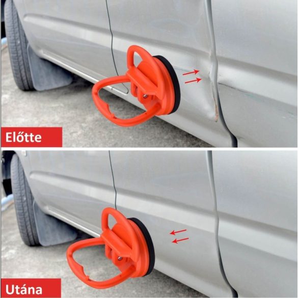 Horpadásjavító tapadókorong